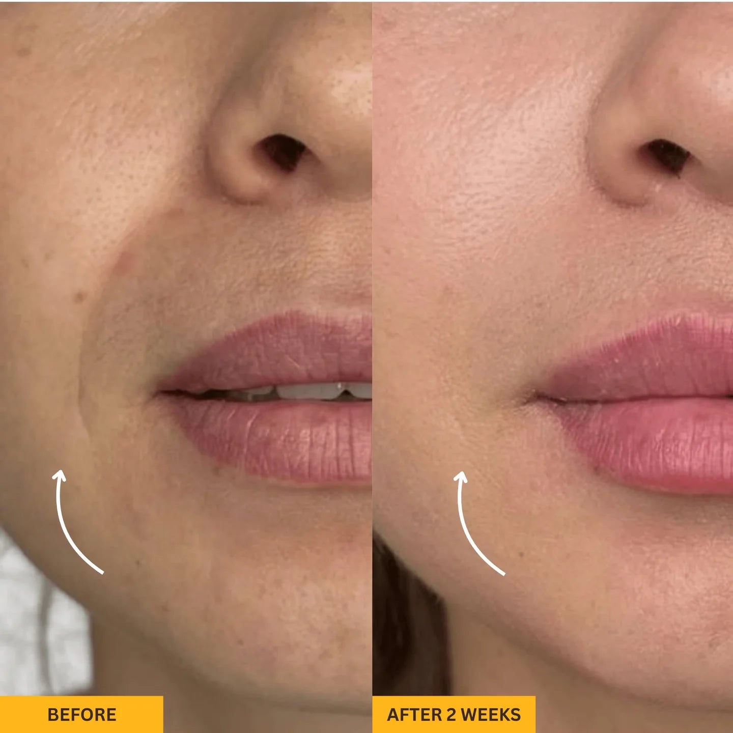 Before and after